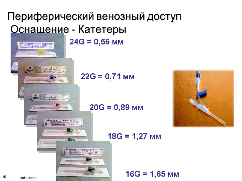 15 Периферический венозный доступ  Оснащение - Катетеры 24G = 0,56 мм  